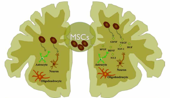 How Does Stem Cell Therapy Work for Neurodegenerative Diseases?