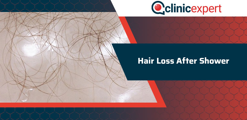 Hair Fall After Shower: Tips to Prevent Excess Loss