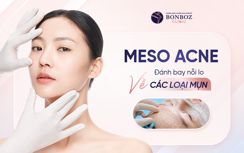 Meso Acne - Đánh bay nỗi lo về mụn