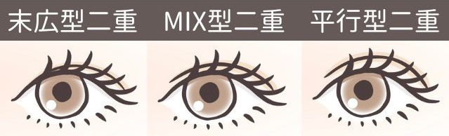 二重デザイン　埋没法　末広型　MIX型　平行型