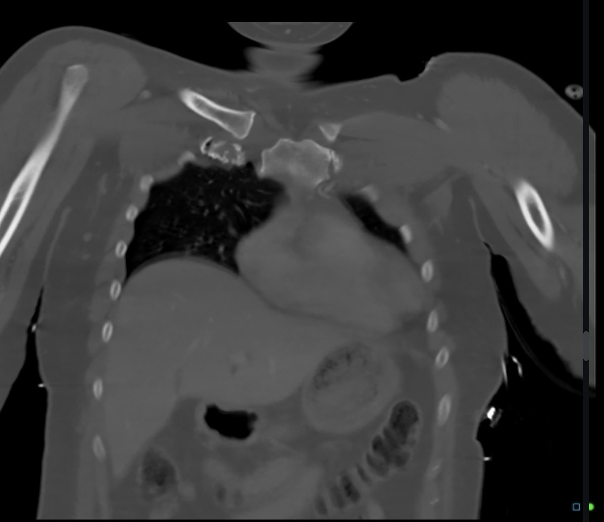 A x-ray of a person's body

Description automatically generated