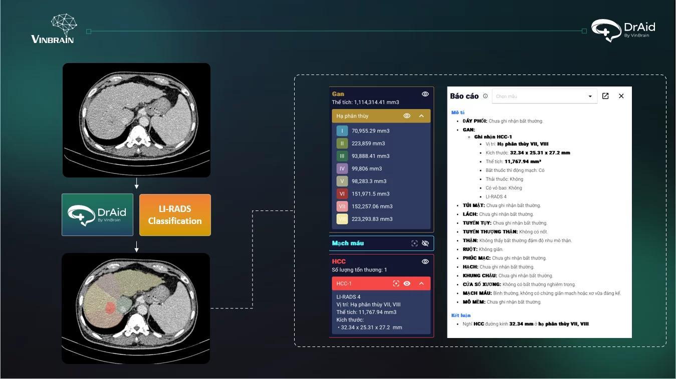 VinBrain triển khai phần mềm AI sàng lọc Lao tại Bệnh viện Phổi Trung ương - AD 4nXcWrseXOcV3lhI9r6cyL82JRuYJGRsWoK hMAOz7cdrWTqz nDsYJ TqJB4SSHwCxpNGByNFG6hDga5WMCpKVRIY Xt6y9IBIqcfDzvC7iV816BGPQ6hIkCHb1eL9nmBZXAk6q2jB8XcHWn6wzUk3iCjJx7SjvIR x