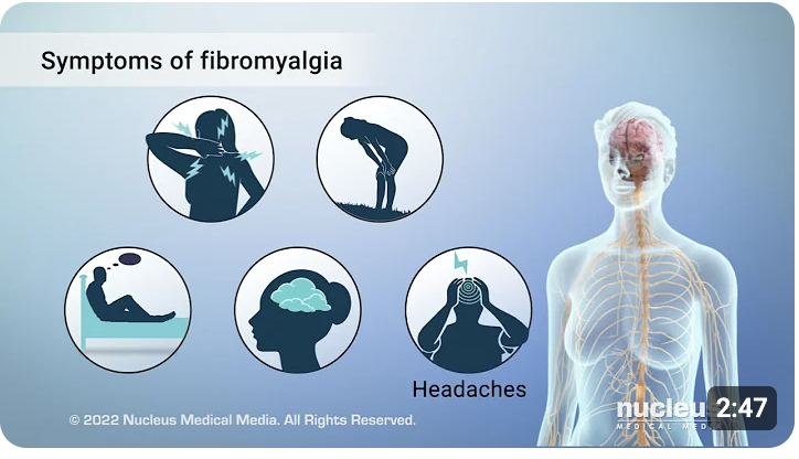 Symptoms of fibromyalgia