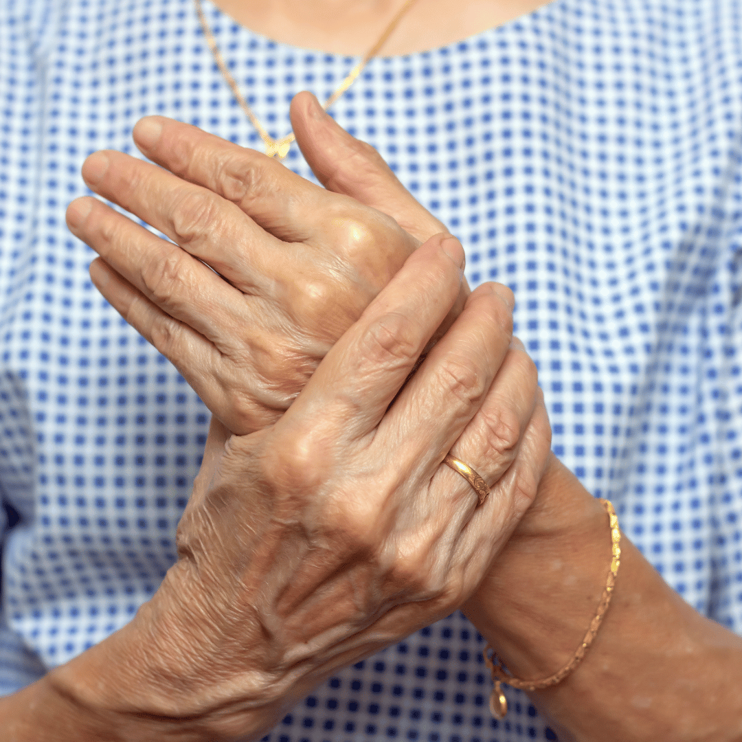 Patient holding their wrist