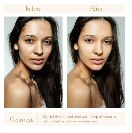 Check out this "Before and After" Template on Canva: