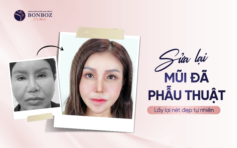 Sửa lại mũi đã phẫu thuật - Lấy lại nét đẹp tự nhiên 