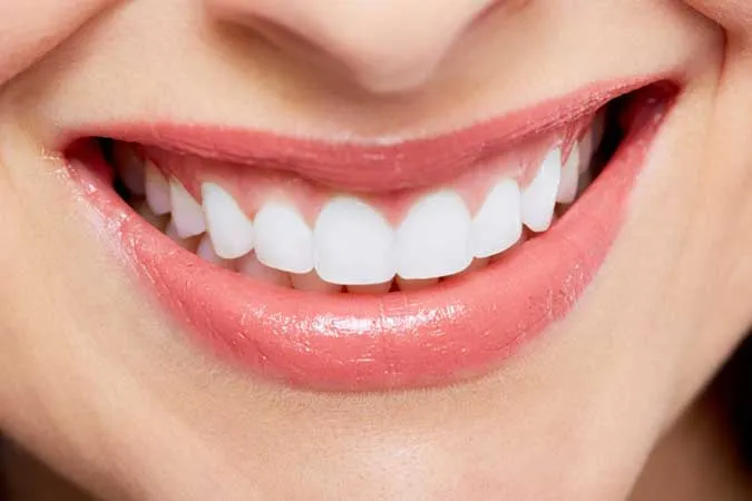 dental makeover cases Dental whitening Technology