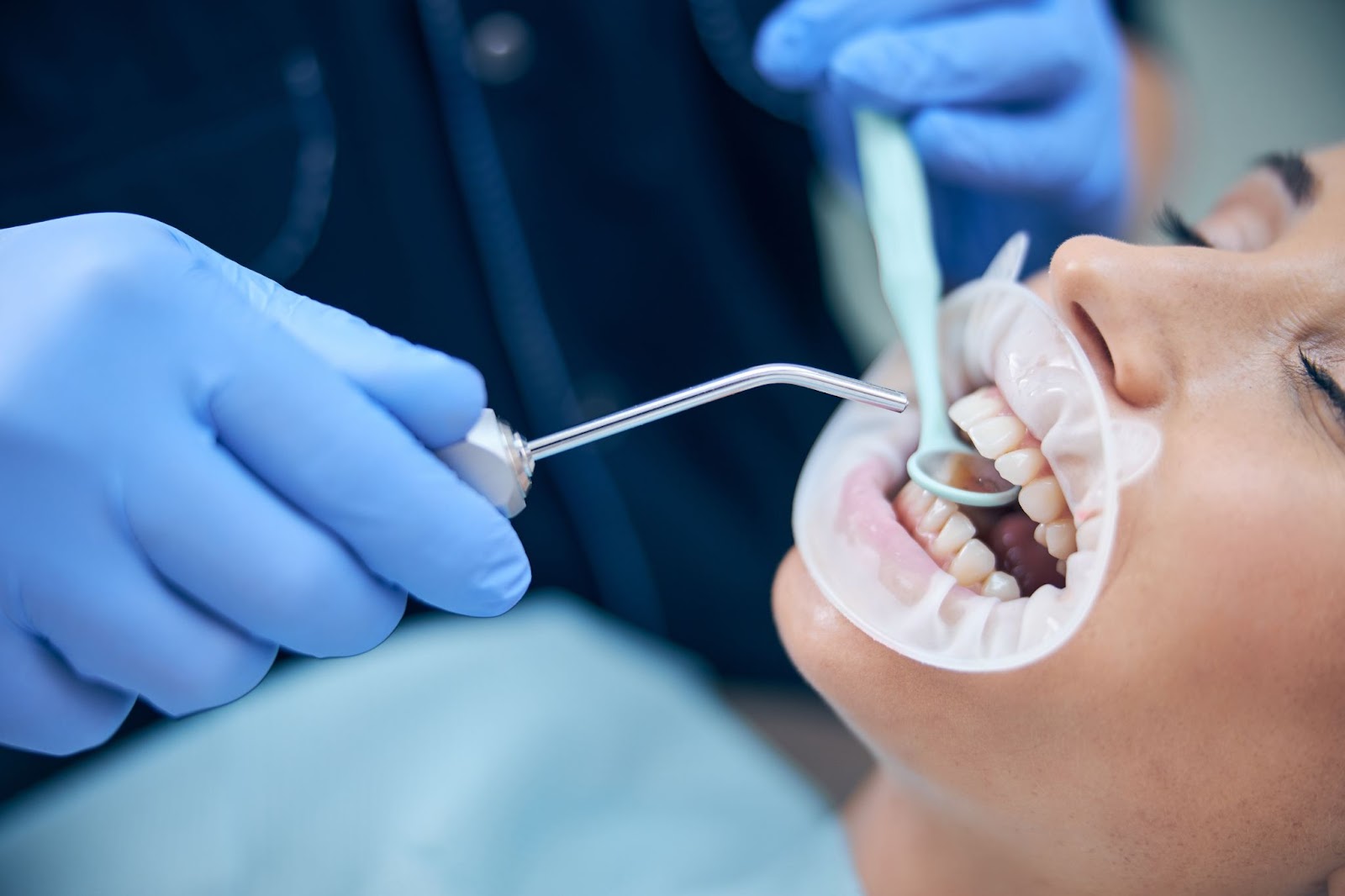 A close-up of a young woman receiving dental care, with a dentist's hand in purple latex gloves, holding a dental mirror and air-water syringe to examine her teeth.