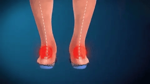 Zapatos ortopédicos con detalles de diseño únicos.