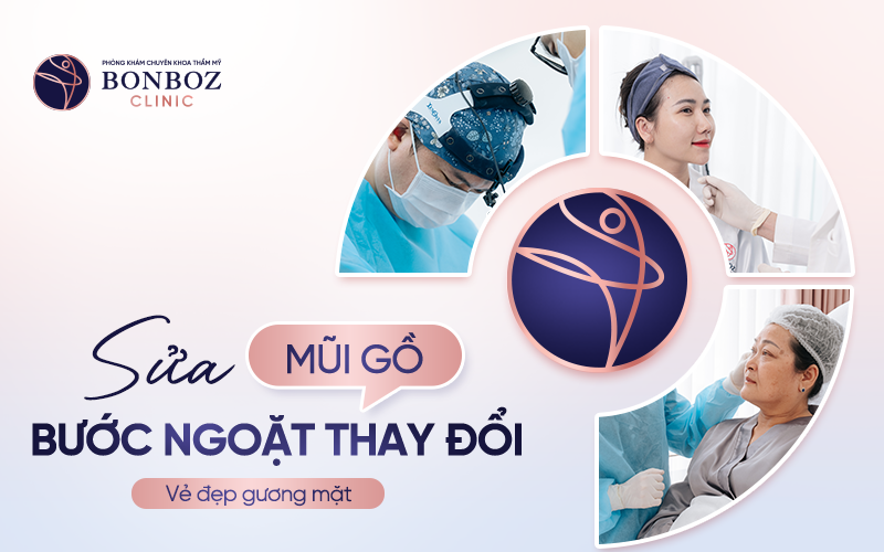 Sửa mũi gồ: Bước ngoặt thay đổi vẻ đẹp khuôn mặt