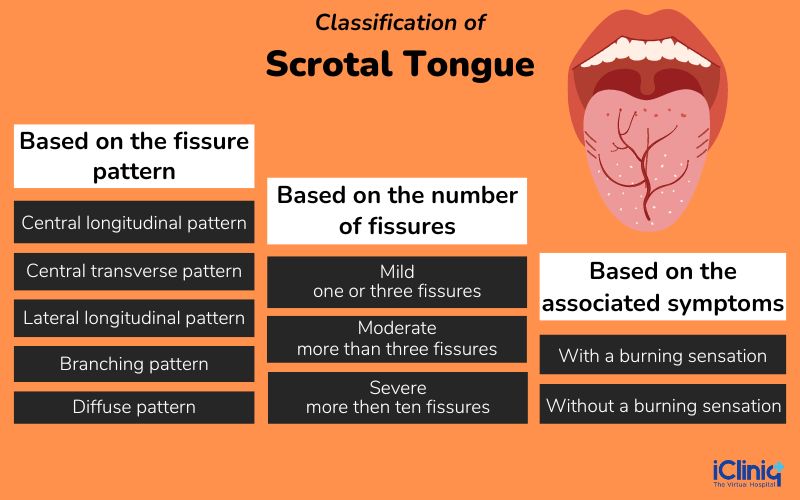 Classification of scrotal tongue