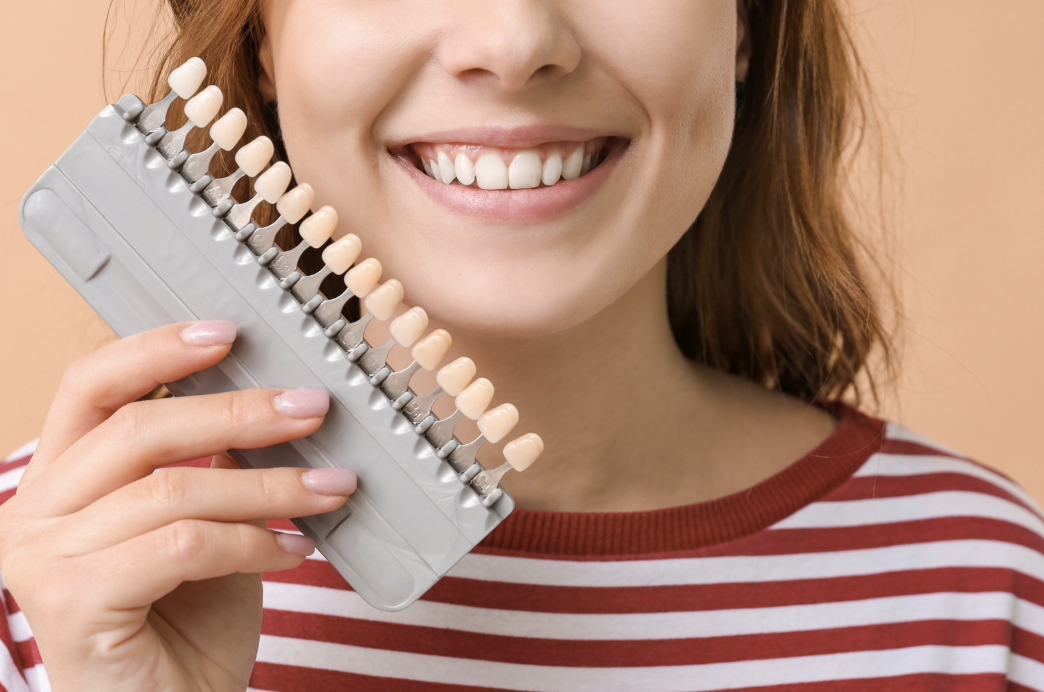 Different shades of veneers