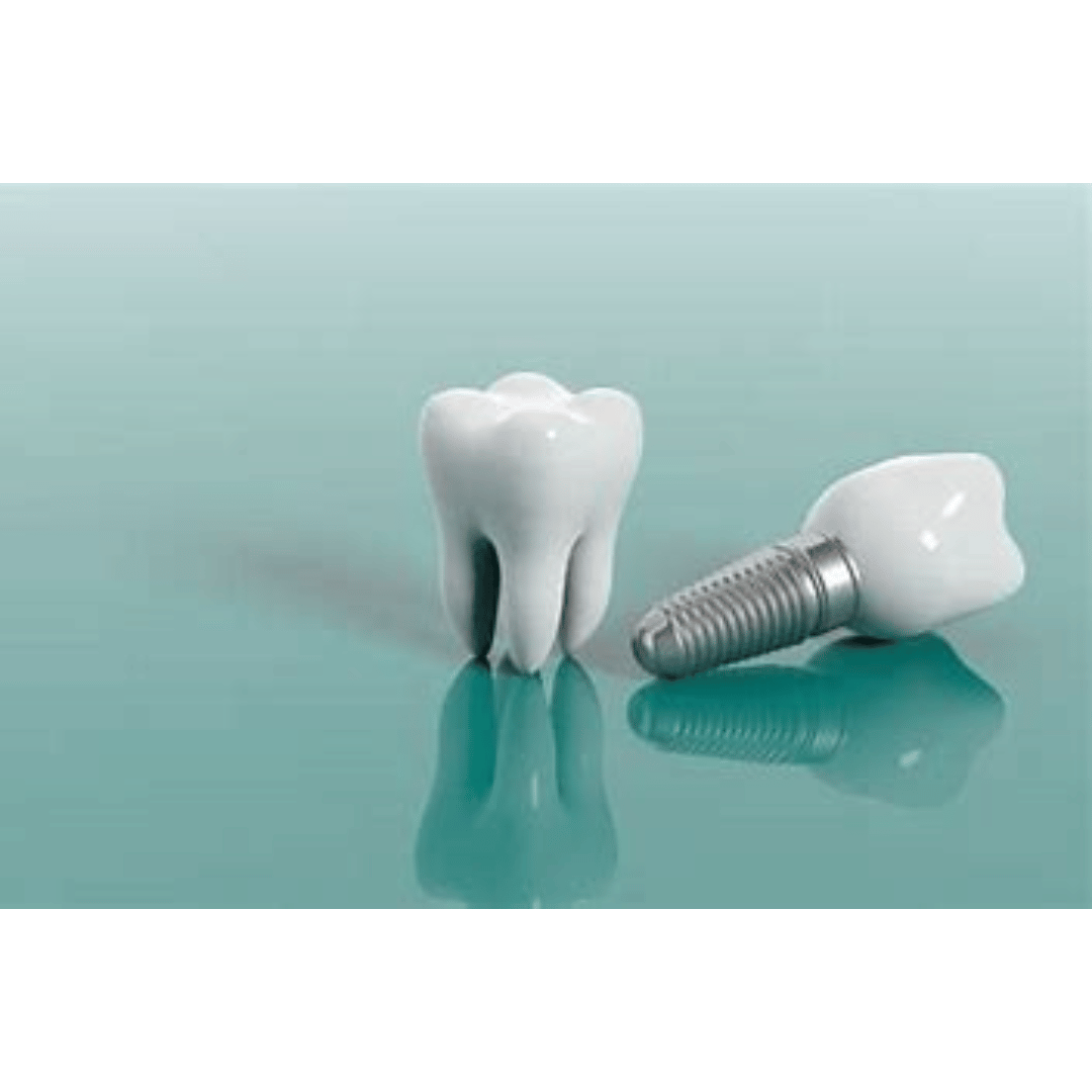 How Do Dental Implants Work