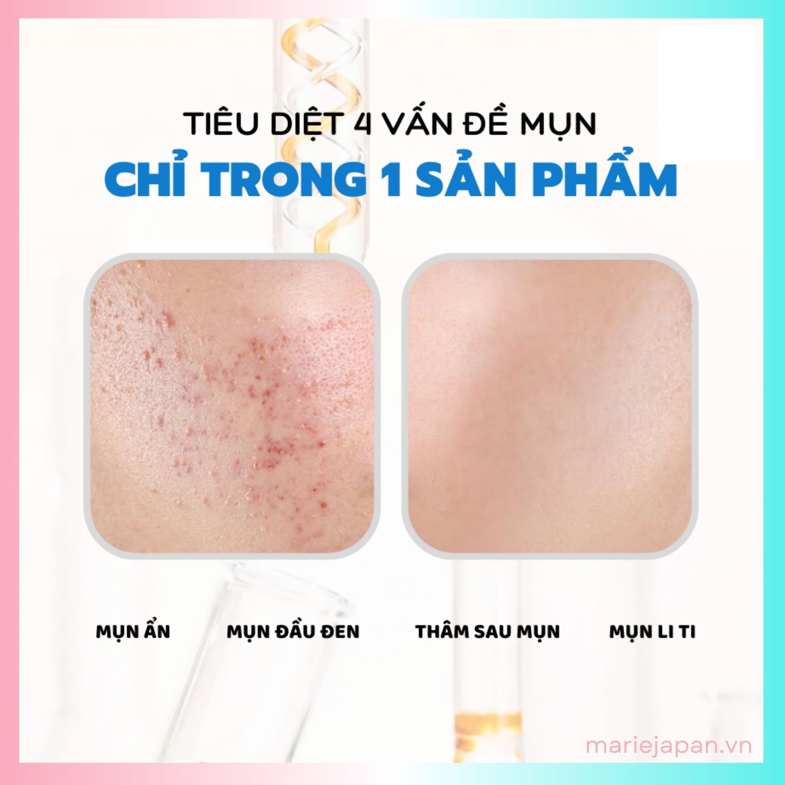 Ai có thể sử dụng Gel giảm mụn Actidem Derma?