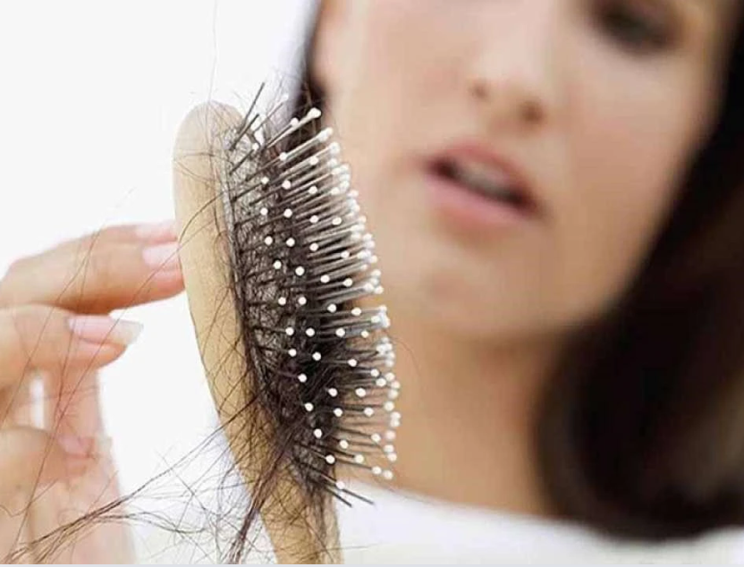 Mỗi lần gội đầu rụng một nắm tóc? Nguyên nhân và cách khắc phục