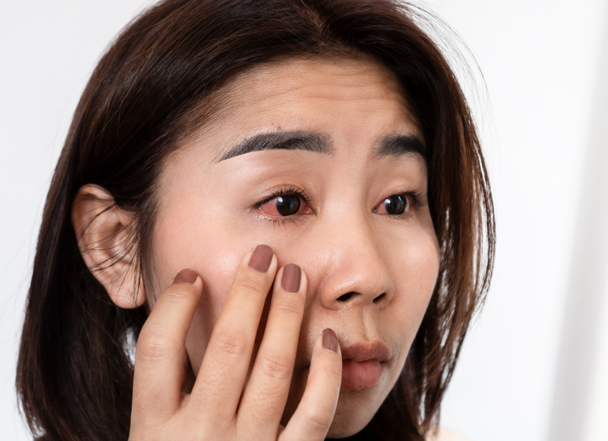 女性揉著紅腫的眼睛 - 眼睛痛怎麼辦？