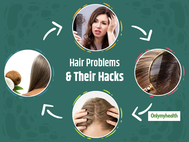 How Do I Stop Dandruff And Hairfall: Proven Solutions