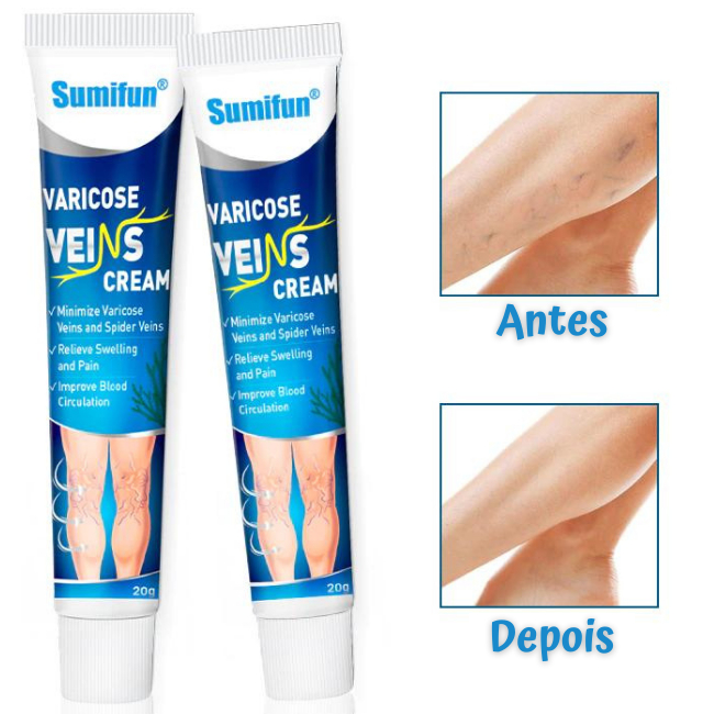 Varicose Veins Creme  Varicose Veins Cream  Varicose  Creme Para Varise  Creme Para Varises  Creme Para Varizes  Creme Para Varize