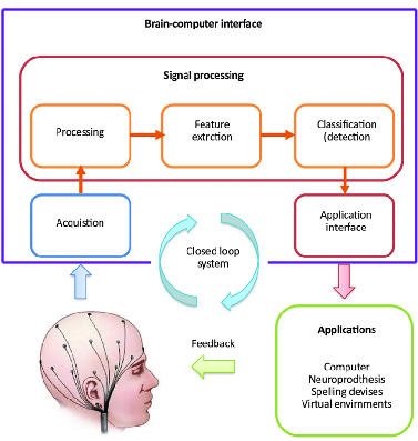 Neuralink Implants  |