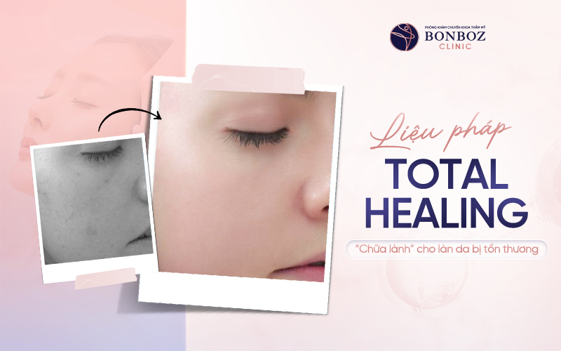 Liệu pháp Total Healing - “Chữa lành” cho làn da bị tổn thương