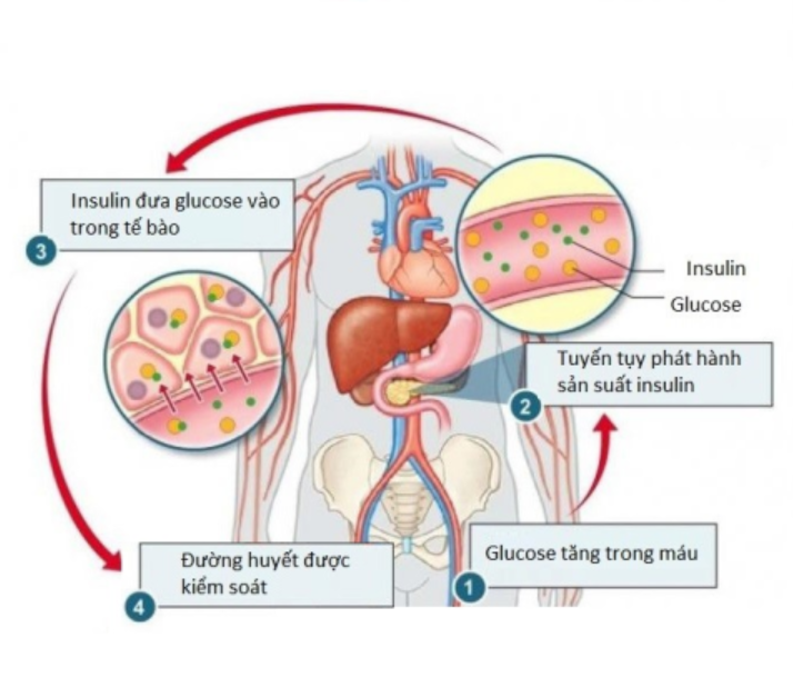 Insulin giúp glucose đến từng tế bào trong cơ thể