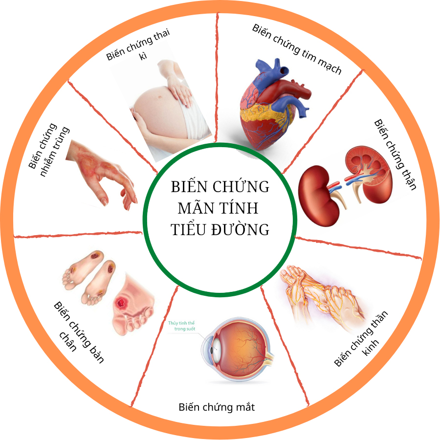 Biến chứng mãn tính của bệnh tiểu đường