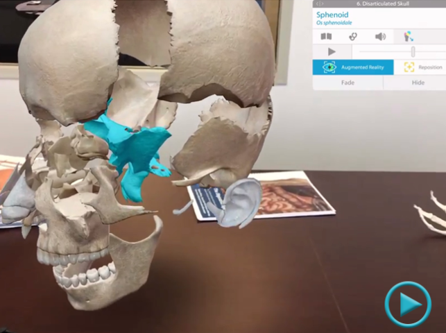 augmented reality - healthcare 