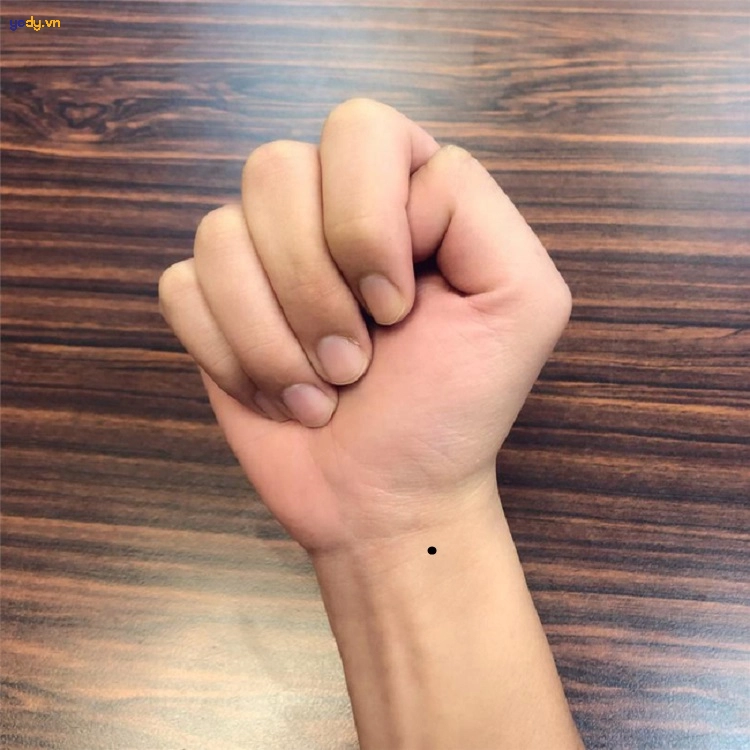 Một số ý nghĩa nốt ruồi ở vị trí khác của tay