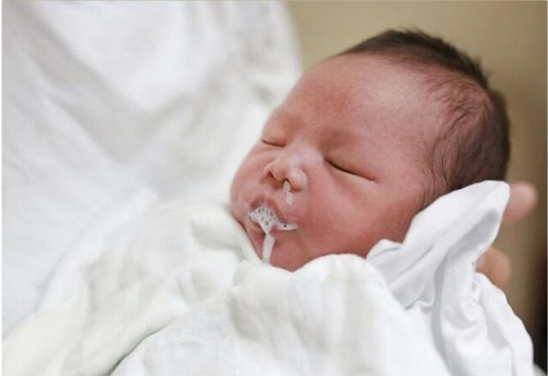 Mách mẹ cách xử lý hiệu quả khi trẻ sơ sinh ọc sữa và thở khò khè