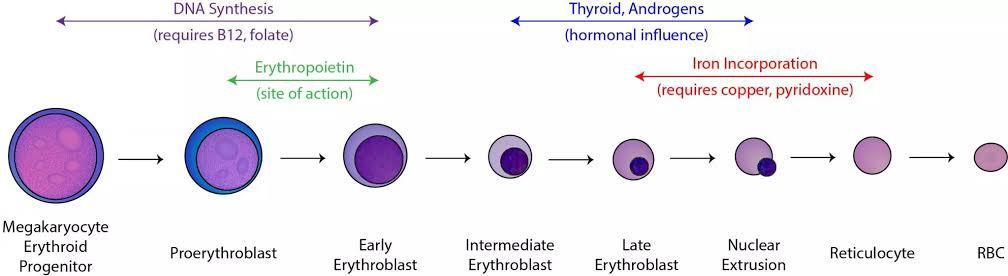 Iron Deficiency Anemia