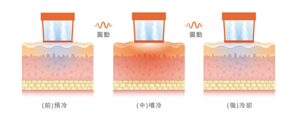 玩美電波冷卻原理。