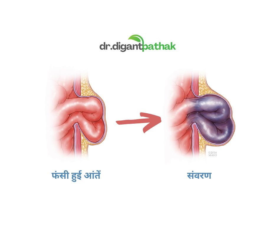 AD 4nXdxPQE9RZglbhnqNR 0TpC8yhtmgsZN3uX9w7VMvW7PsrvHcarKKVn0eZlrlawq5fFl - Laparoscopic Surgeon Dr. Digant Pathak