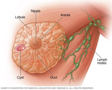 Breast cysts - Symptoms and causes - Mayo Clinic