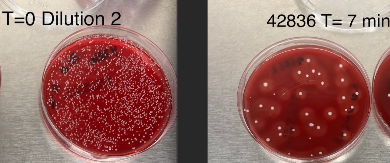 Side-by-side comparison of two petri dishes to show if tea tree oil does help with acne. The petri dish on the left, labeled 