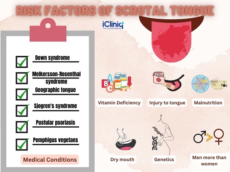 Risk Factors of Scrotal Tongue