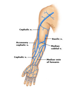 Basilica vein and Cephalic