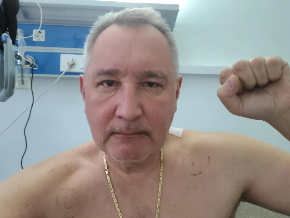 Dmitry Rogozin after being wounded