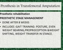 Gambar Prosthetic Rehabilitation: Gait and Posture