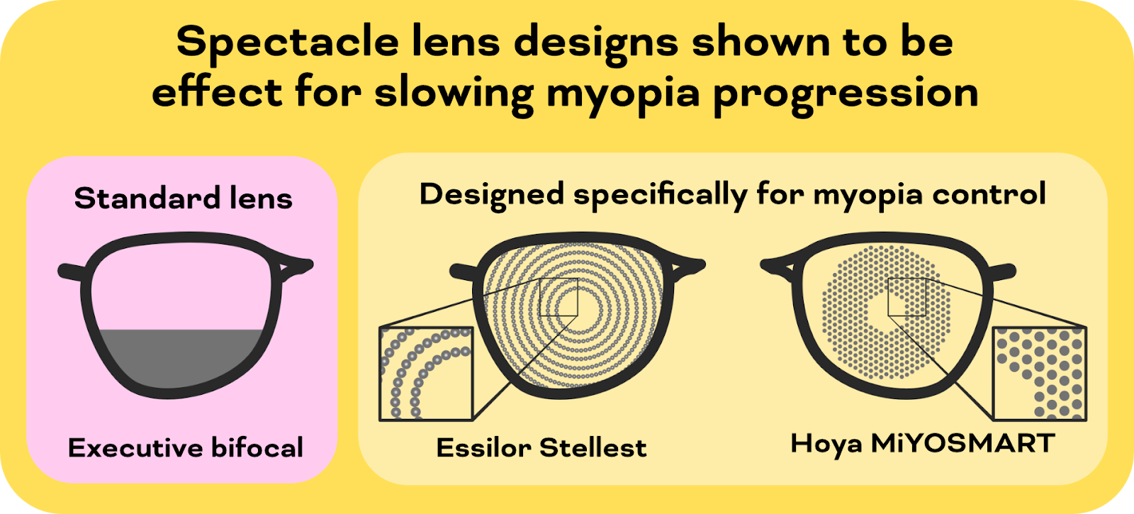 Spectacle lens designs for myopia control (Source:https://www.mykidsvision.org/knowledge-centre/all-about-eye-glasses-for-myopia-control)