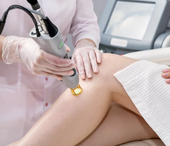 A person receiving laser treatment on a person's leg

Description automatically generated