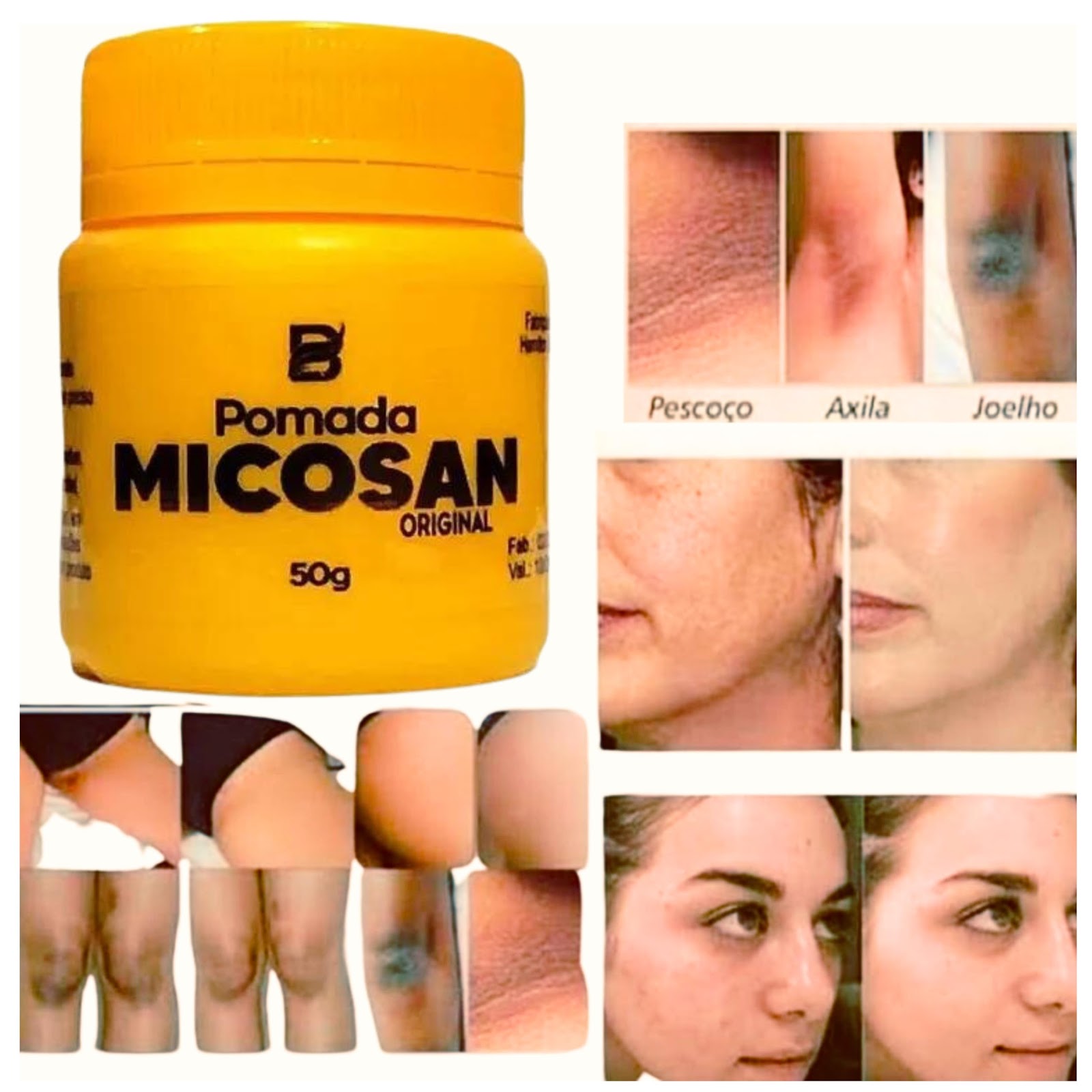 Pomada Micosan  Micosan  Micosan Pomada  Creme Micosan  Micosan Para Cicatrizes  Creme Para Cicatriz  pomada para cicatrização