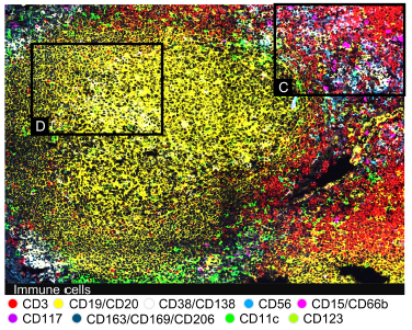 perfil espacial de tonsilas palatinas humanas