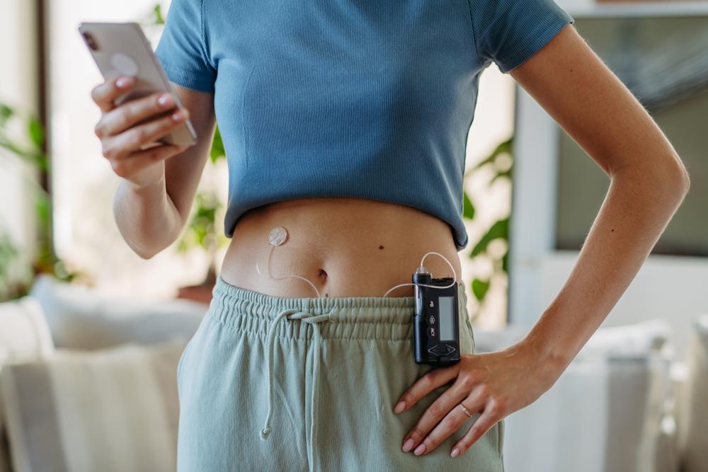 woman wearing an insulin pump