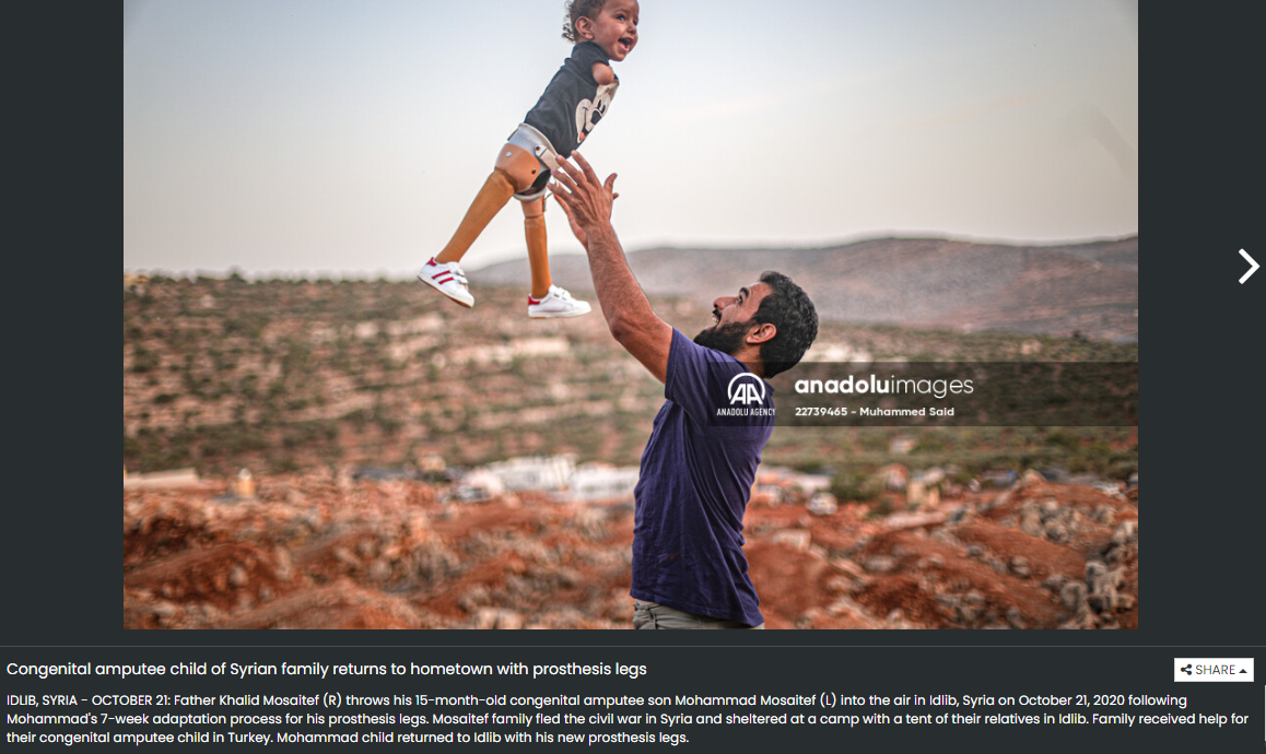 طفل سوري مع والده بعد تركيب أطراف صناعية له