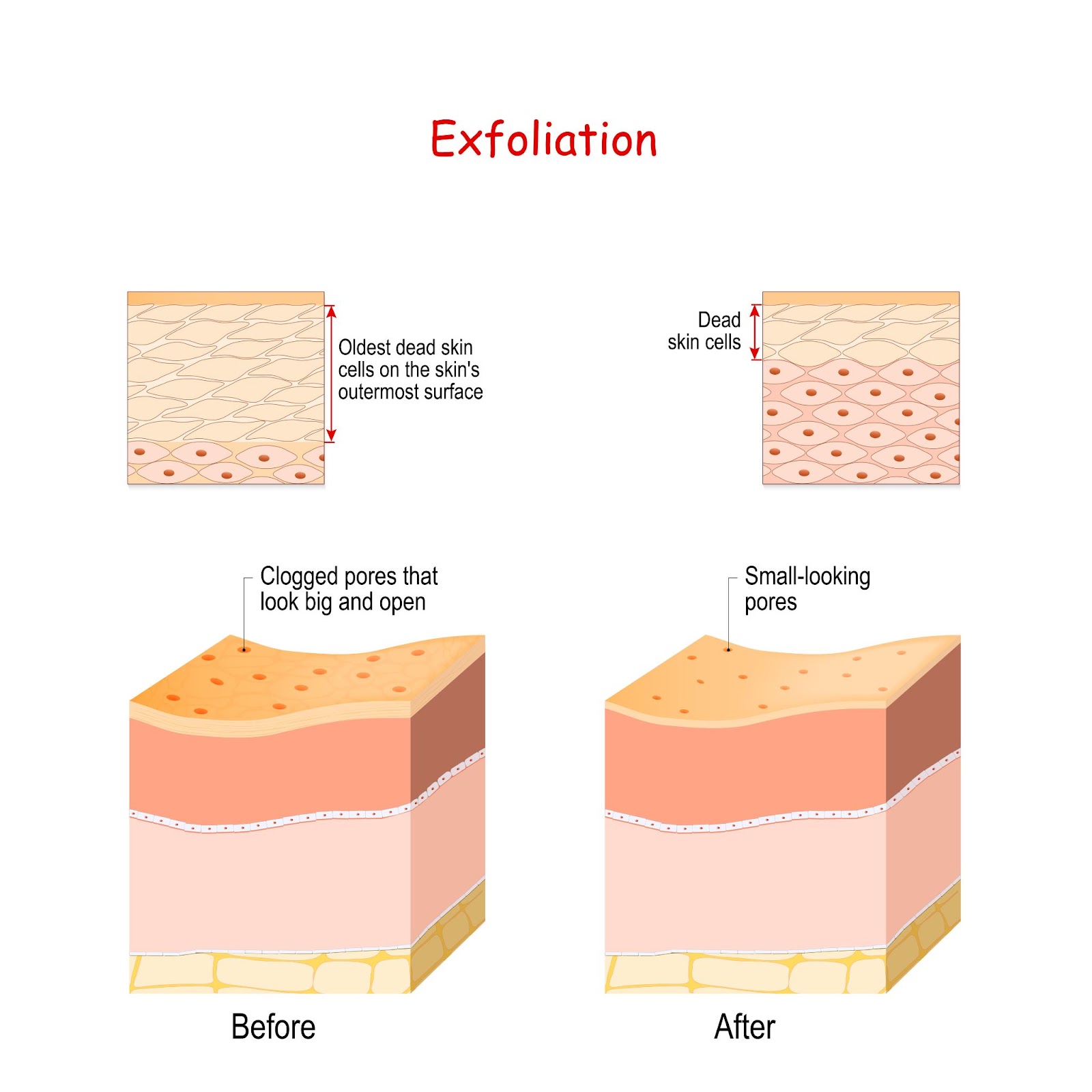 skin layer exfoliation