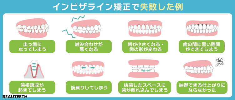 インビザライン矯正で失敗した8つの事例