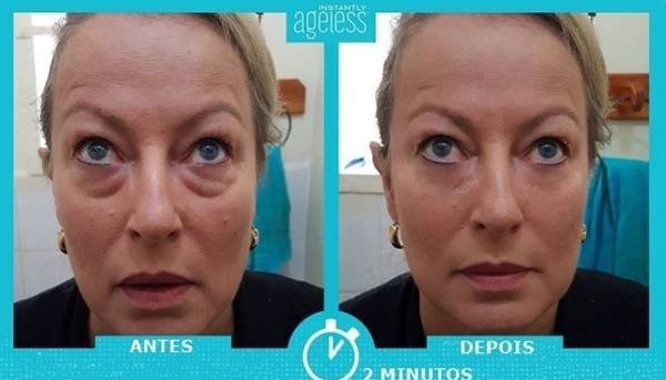 Creme Ageless  Ageless  Instantly Ageless  Creme Instantly Ageless  Creme para Oheira  Creme para rugas  Creme para linhas de expressão