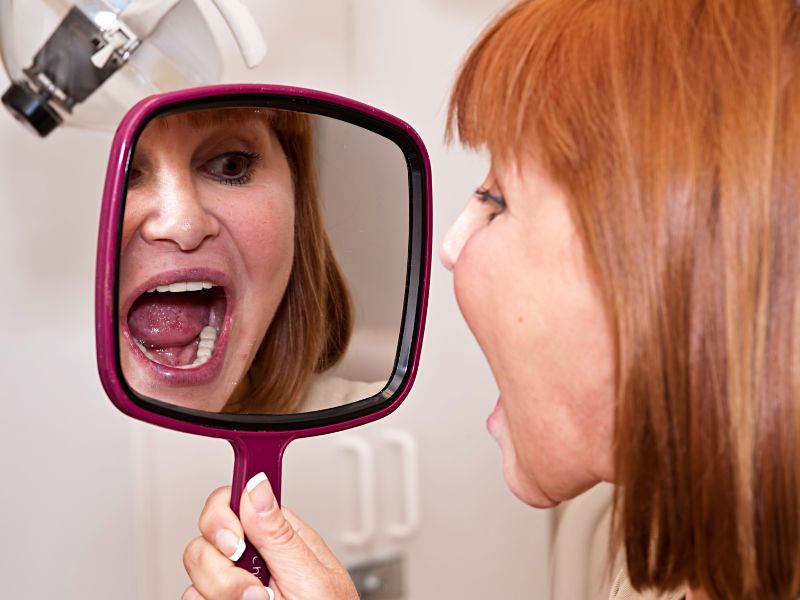 como é feito um implante dentário fotos higiene