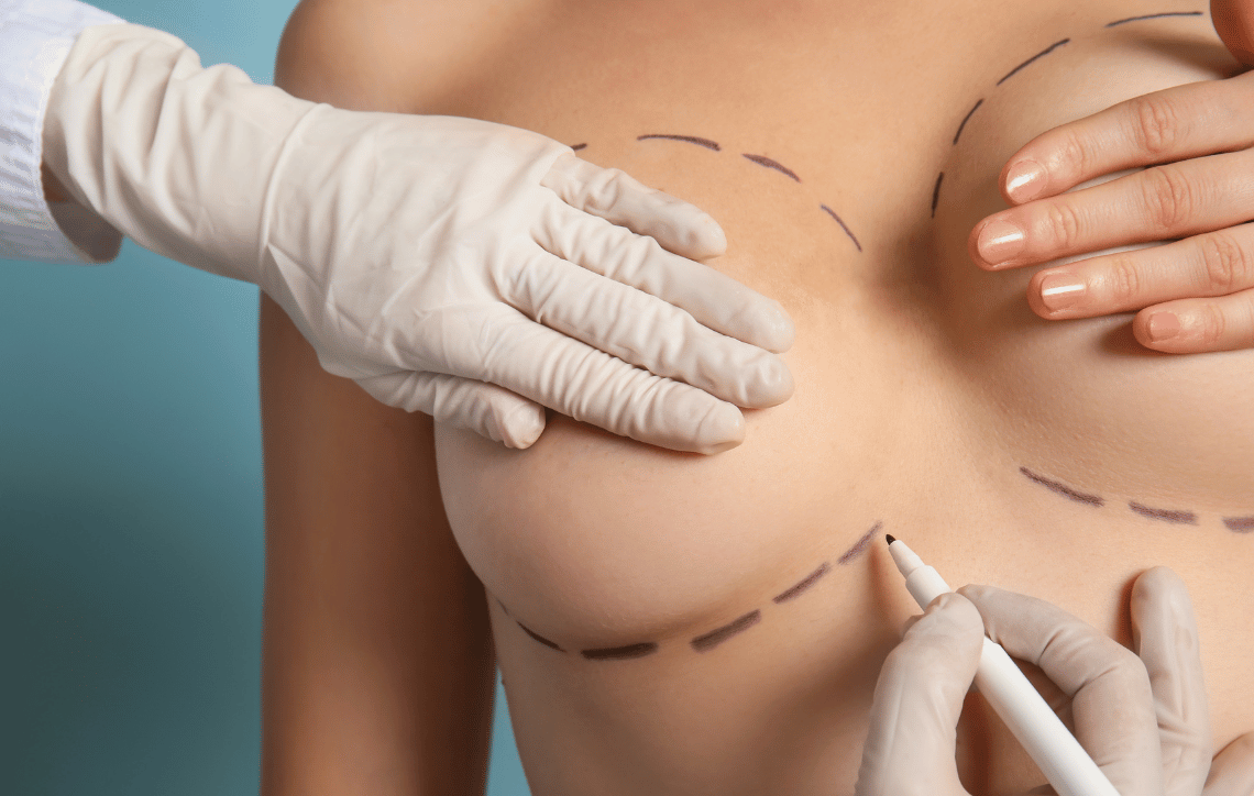 Breast reduction surgery