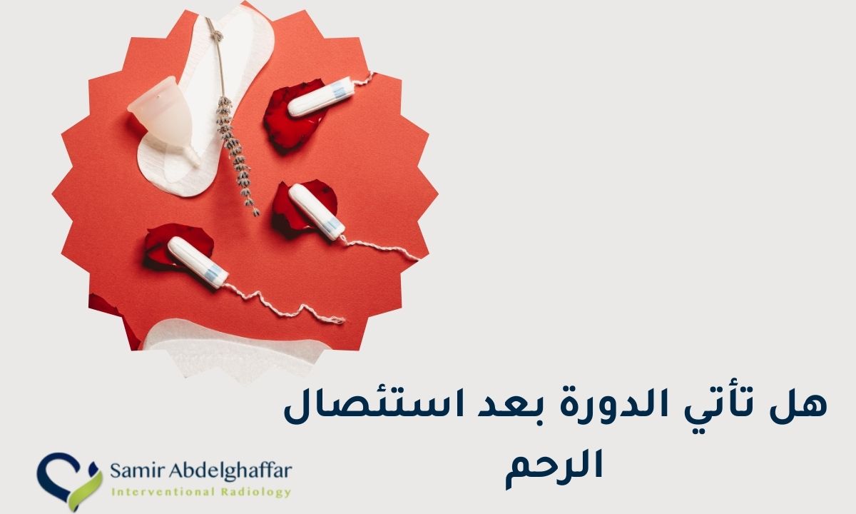 هل تأتي الدورة بعد استئصال الرحم؟ اعرفي سبب حدوثها بعد الاستئصال!